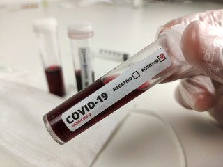 Coronavirus (COVID-19) medical test (positive and negative)