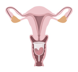 Vector illustration of female reproductive system with a menstrual cup inside, feminine period hygiene product, blood collector that is eco way of protection for women during critical days.