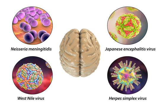 Microorganisms that cause brain infections
