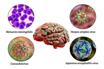 Microorganisms that cause brain infections