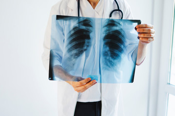 The doctor is holding an X-ray of his lungs. International doctor's day. Doctor on the front line.