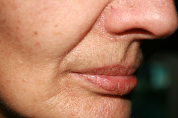 Obraz premium Wrinkles on the lips and chin. Nasolabial folds. Fluff mustache.