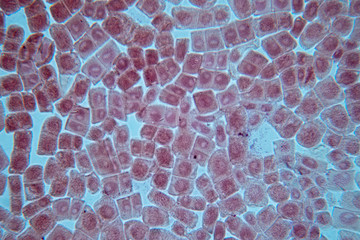 Root tip of Onion and Mitosis cell in the Root tip of Onion under a microscope.

