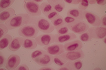 Root tip of Onion and Mitosis cell in the Root tip of Onion under a microscope.
