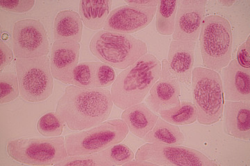 Root tip of Onion and Mitosis cell in the Root tip of Onion under a microscope.
