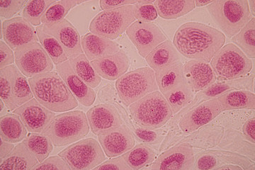 Root tip of Onion and Mitosis cell in the Root tip of Onion under a microscope.
