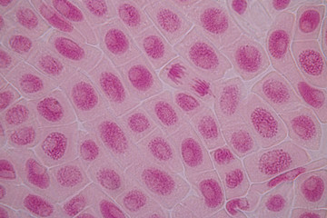 Root tip of Onion and Mitosis cell in the Root tip of Onion under a microscope.
