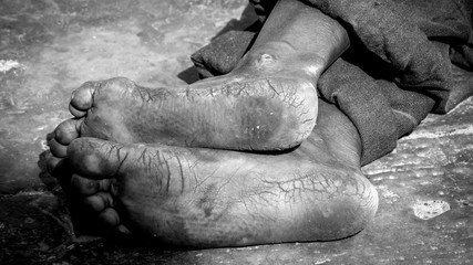 dirty soles of feet of indian man