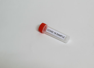 Test tube with sample for SARS-CoV-2 or COVID-19 virus test