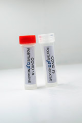 Testing for presence of coronavirus. Tube containing a swab sample that has tested positive for COVID-19.
