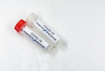 Testing for presence of coronavirus. Tube containing a swab sample that has tested positive for COVID-19.