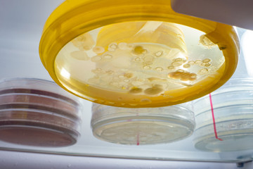 Petri dishes with samples of microorganisms in a laboratory refrigerator