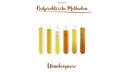 Heilpraktiker Heilkunde Urindiagnostik Urintherapie Aquarell Wasserfarbe Heilpraktische Methode Reagenzgläser