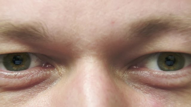Crazy eyes of a tired sick man, monitor reflection, camera movement, close-up