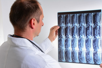 MRI scan of human lumbar spine with doctor. Doctor looking at MRI of spinal cord.