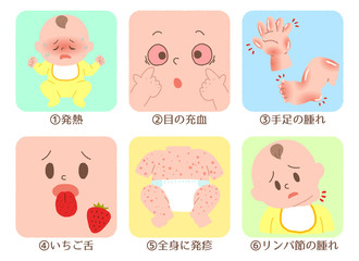 赤ちゃん　川崎病　症状　セット