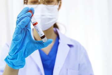 Scientist holding Coronavirus covid-19 infected blood sample tube DNA testing of the blood in the...