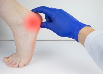 An orthopedic doctor examines a woman's leg. Heel pain, tendon stretching, inflammation, heel spur....