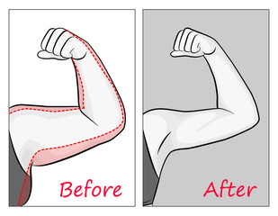 Female hand before and after playing sports. Red outline showing excess weight.