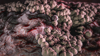 Science Photo of bacteria Candida albicans is an opportunistic pathogenic yeast that is a common...