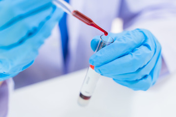 Technician scientist analyzing a blood sample in laboratory, Virus analysis.