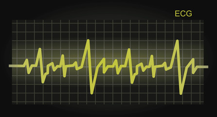 ECG. Electrocardiograph background. vector illustration