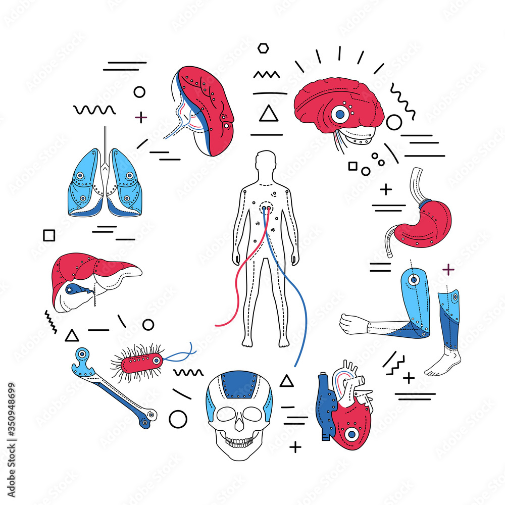Poster artificial limbs web banner. prosthetic implants of different organs and parts of body. infographics
