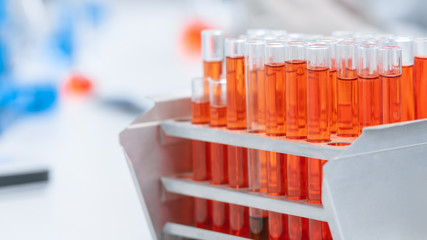 close up. tubes with test results on the lab table.