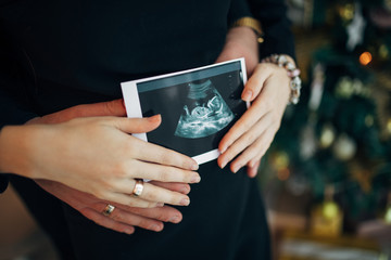 Pregnant couple holding ultrasound scan. Concept of Pregnancy health care
