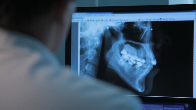 The dentist works on Functional diagnostics of the lower jaw joints of the patient in a special program on a computer.TMJD or TMD.