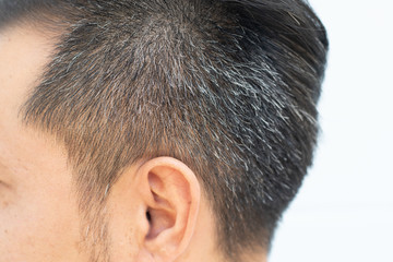 Close up gray hair on the head of Asia young male