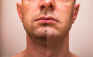 Obraz premium Closeup of man with beard on half of the face on grey background. Portrait of a handsome man with a shaved half his face.