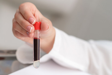 Close up of hand of doctor or nurse holding test tube with blood in the lab.