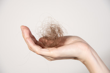 Hair loss. Hands with shreds of hair close-up