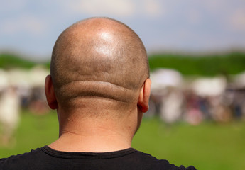 A short haircut on a man’s head