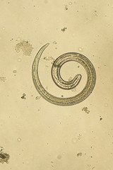 Trichinella spiralis - parasitic nematoda worm microscope
