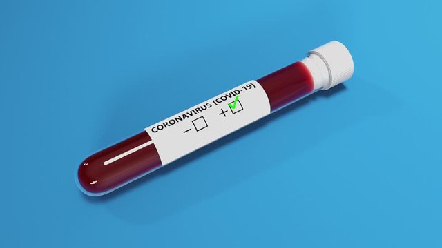 3D animation of Covid-19 blood test tube showing positive case. Tube rolls on blue ground untill it stops