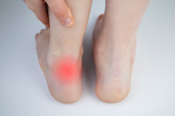 An orthopedic doctor examines a woman's leg. Achilles tendon and ankle diseases. Inflammation of...