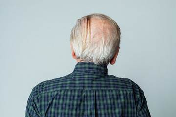 Rear view of a senior man crown balding