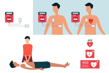 Set of automated external defibrillator, AED and cardiopulmonary resuscitation. - obrazy, fototapety, plakaty