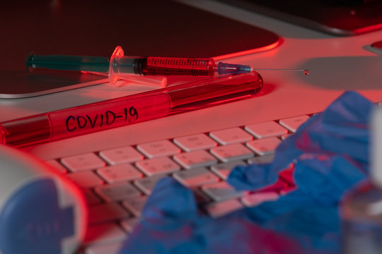 tube test with blood sample for COVID-19 test  coronavirus found in  - Powered by Adobe