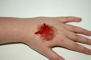 blood in hand