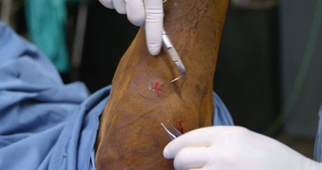 Surgeon operating a horse in operation theater - Powered by Adobe