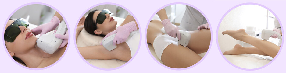 Collage with photos of woman undergoing laser epilation procedure. Banner design - obrazy, fototapety, plakaty