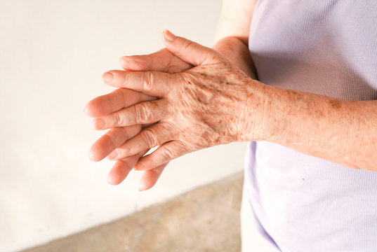 Aging hands of old asian woman rubbing together ,show a lot of freckles ,wrinkles and sagging on the skin ,aging skin and elderly care concept , selective focus
