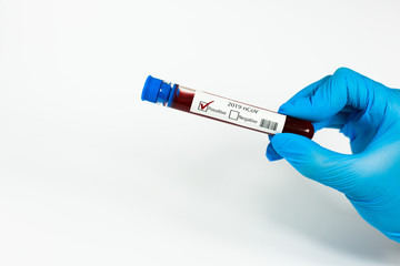 Obraz premium Blood test samples for presence of coronavirus (COVID-19) tube containing a blood sample that has tested positive for coronavirus.