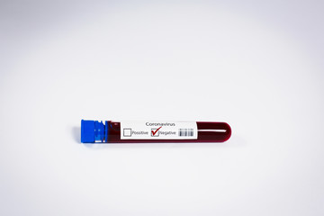 Obraz premium Blood test samples for presence of coronavirus (COVID-19) tube containing a blood sample that has tested negative for coronavirus.