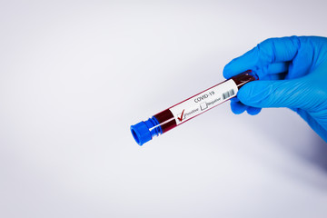 Hand holds a test tube containing a blood positive sample, test tube with blood for Covid-19 (coronavirus) analyzing. Laboratory testing patient’s blood. Blue nitrile glove.