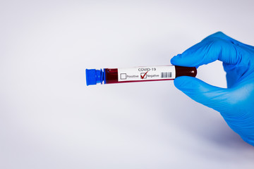 Hand holds a test tube containing a blood negative sample, test tube with blood for Covid-19 (coronavirus) analyzing. Laboratory testing patient’s blood. Blue nitrile glove.