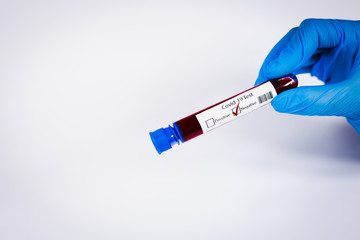 Hand holds a test tube containing a blood negative sample, test tube with blood for Covid-19 (coronavirus) analyzing. Laboratory testing patient’s blood. Blue nitrile glove.